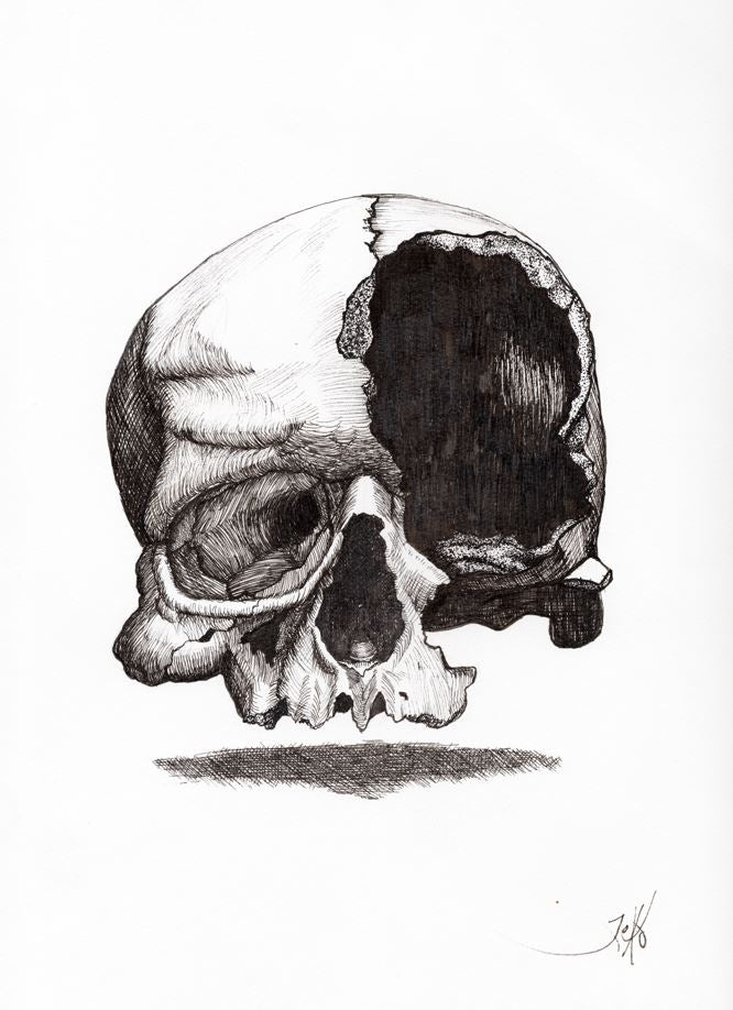 Busted Skull